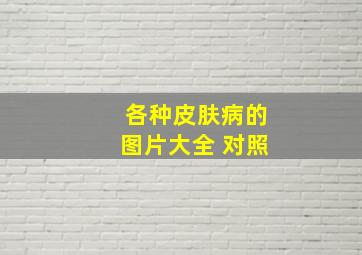 各种皮肤病的图片大全 对照